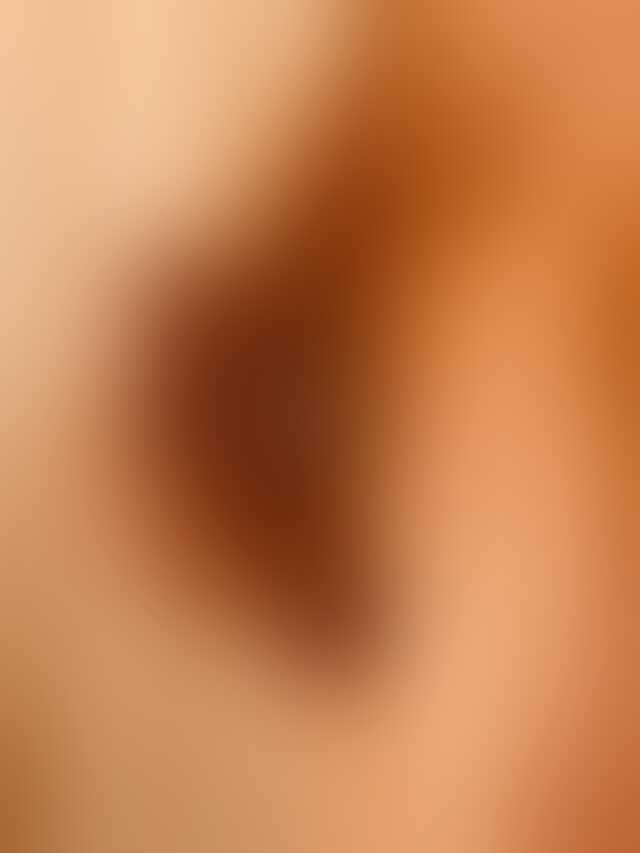 moi 2